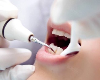 牙龈出血怎么回事?